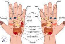 خواب رفتگی دست